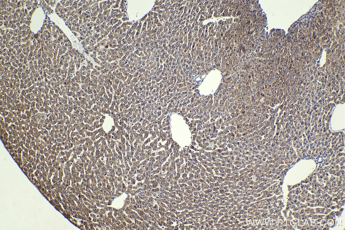 Immunohistochemical analysis of paraffin-embedded mouse liver tissue slide using KHC2273 (PHKA2 IHC Kit).