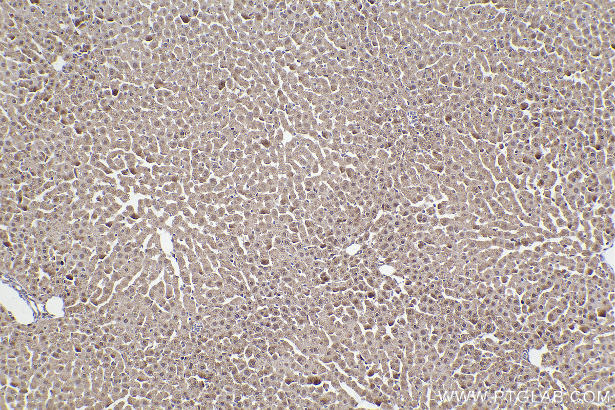 Immunohistochemical analysis of paraffin-embedded rat liver tissue slide using KHC2273 (PHKA2 IHC Kit).