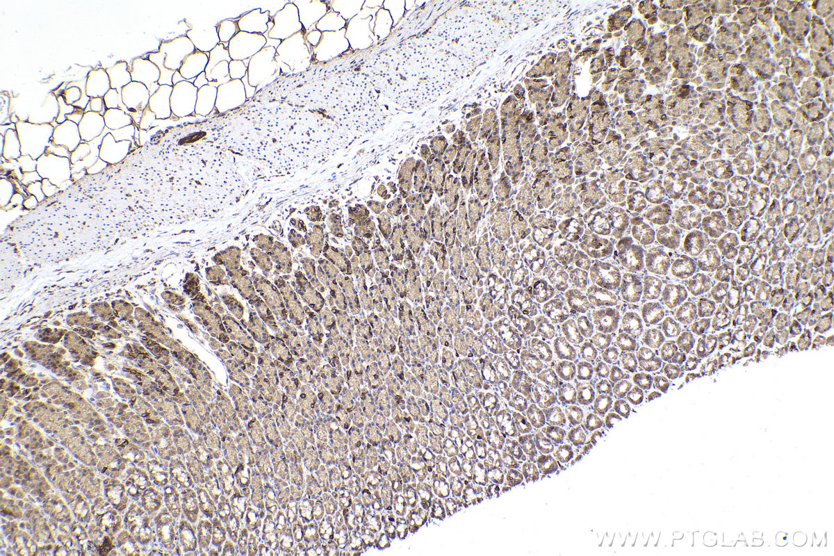 Immunohistochemical analysis of paraffin-embedded rat stomach tissue slide using KHC2273 (PHKA2 IHC Kit).