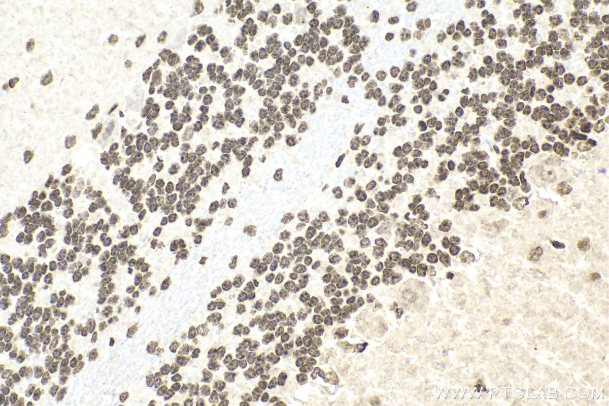 Immunohistochemical analysis of paraffin-embedded rat cerebellum tissue slide using KHC2122 (PIAS1 IHC Kit).