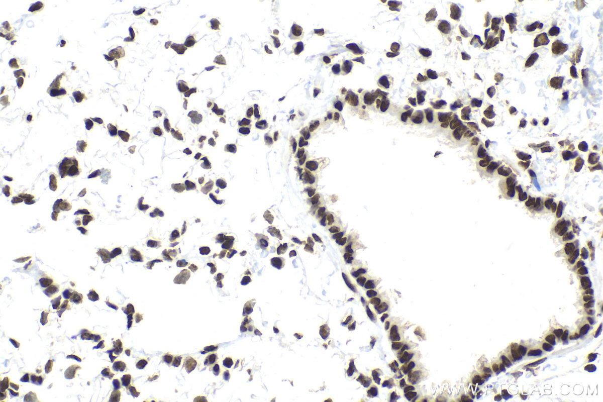 Immunohistochemical analysis of paraffin-embedded rat lung tissue slide using KHC2122 (PIAS1 IHC Kit).