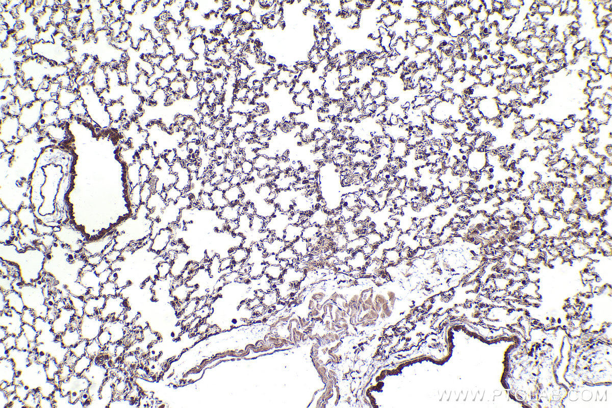 Immunohistochemical analysis of paraffin-embedded mouse lung tissue slide using KHC2429 (PICALM IHC Kit).