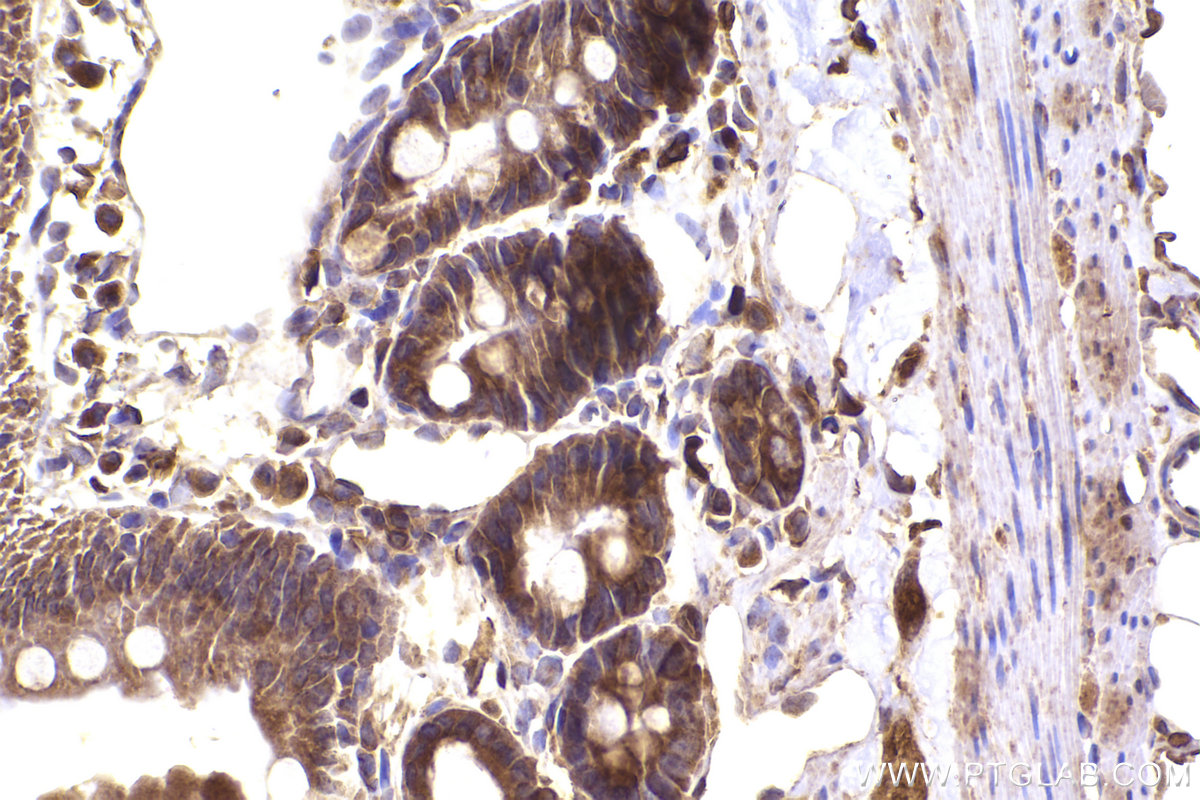 Immunohistochemical analysis of paraffin-embedded rat small intestine tissue slide using KHC2429 (PICALM IHC Kit).