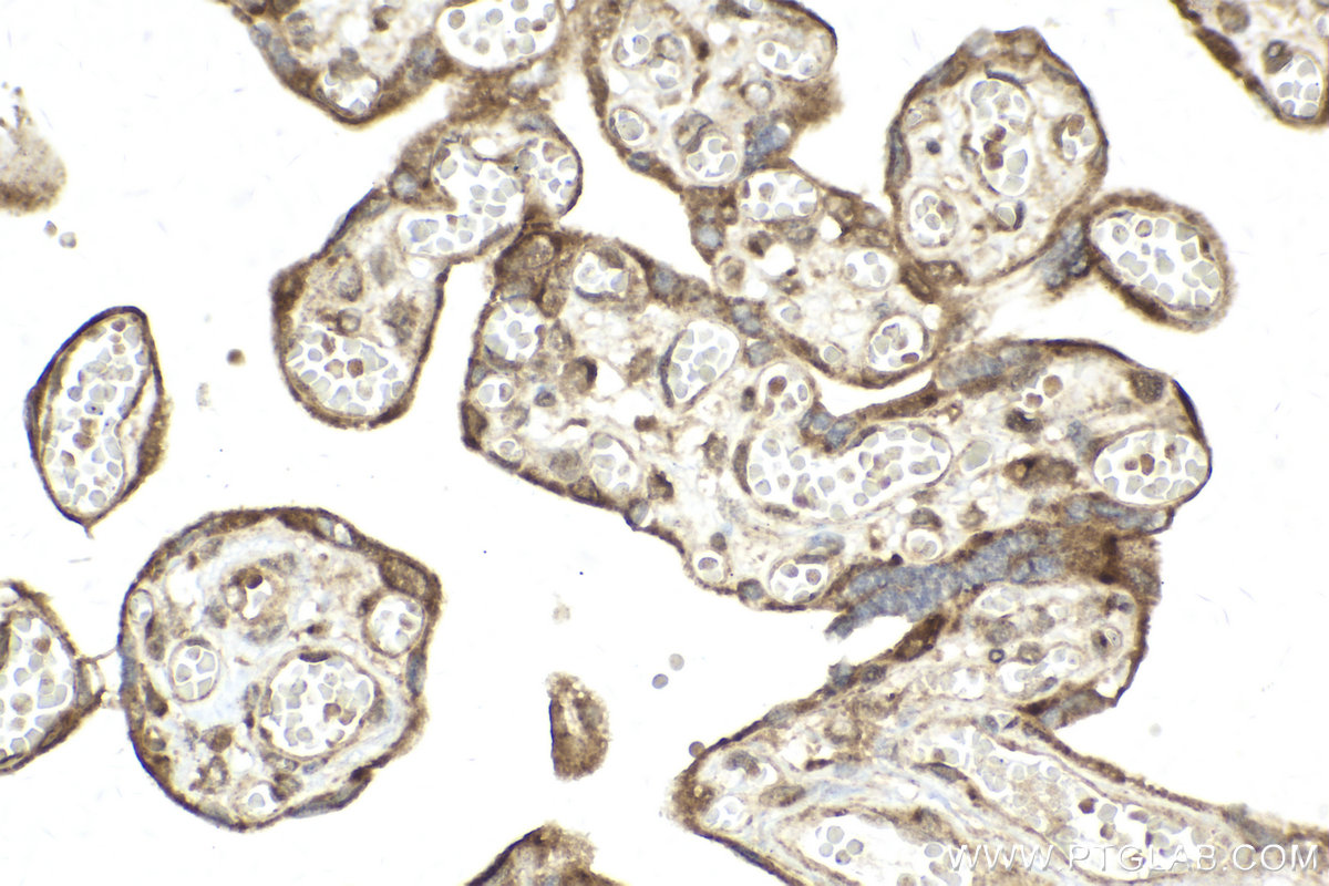 Immunohistochemical analysis of paraffin-embedded human placenta tissue slide using KHC2012 (PIN4 IHC Kit).