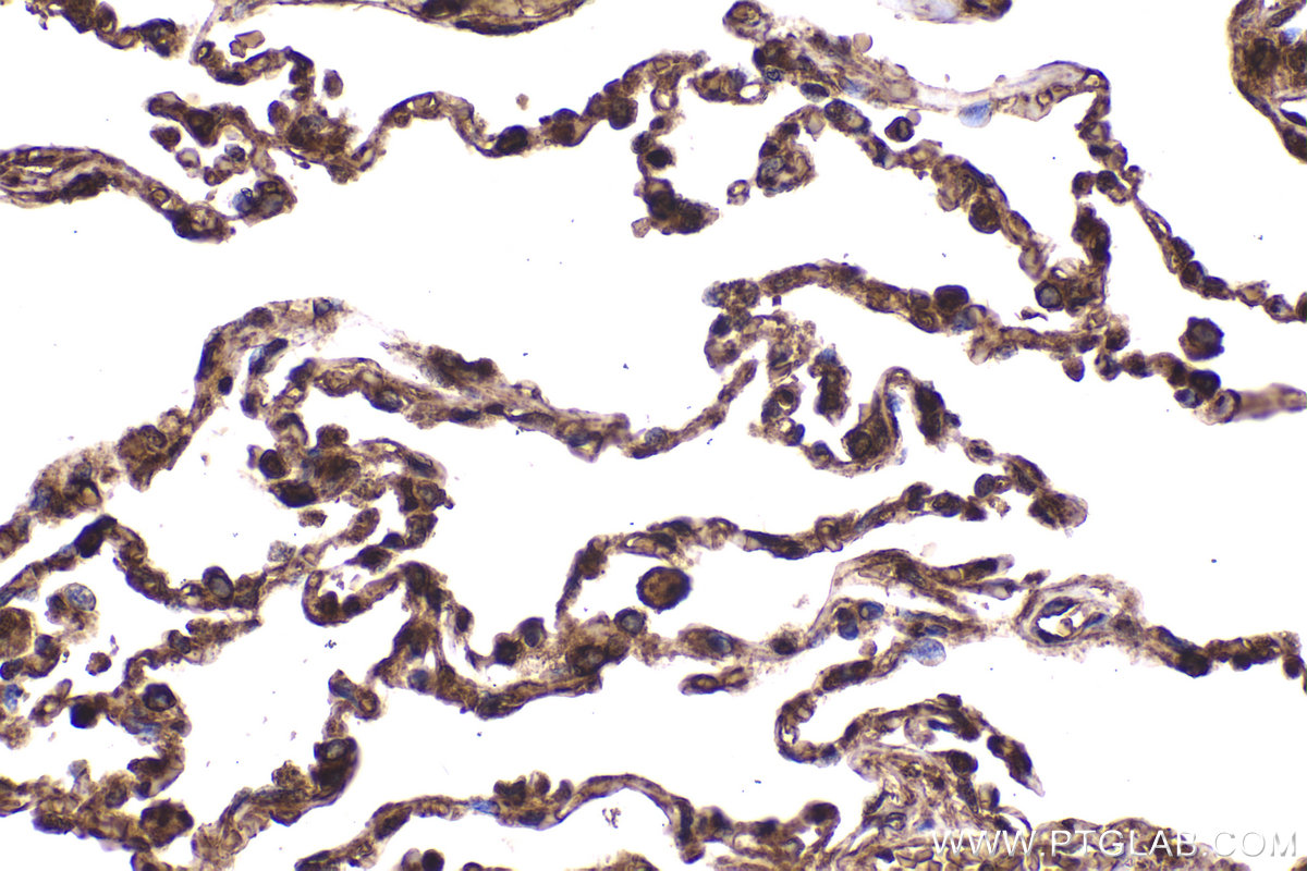 Immunohistochemical analysis of paraffin-embedded human lung tissue slide using KHC2282 (PIP4K2A IHC Kit).