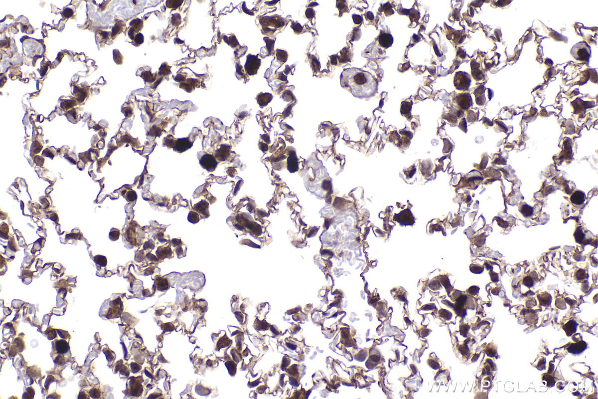 Immunohistochemical analysis of paraffin-embedded mouse lung tissue slide using KHC2282 (PIP4K2A IHC Kit).