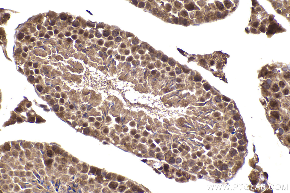 Immunohistochemical analysis of paraffin-embedded mouse testis tissue slide using KHC2282 (PIP4K2A IHC Kit).