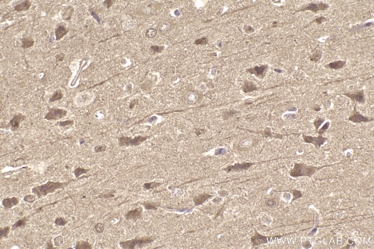 Immunohistochemical analysis of paraffin-embedded rat brain tissue slide using KHC2282 (PIP4K2A IHC Kit).