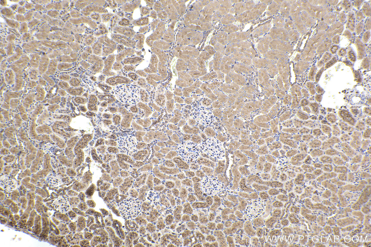 Immunohistochemical analysis of paraffin-embedded rat kidney tissue slide using KHC2363 (PIP4K2B IHC Kit).