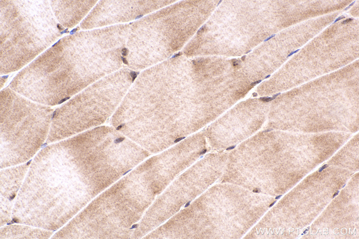 Immunohistochemical analysis of paraffin-embedded mouse skeletal muscle tissue slide using KHC2363 (PIP4K2B IHC Kit).