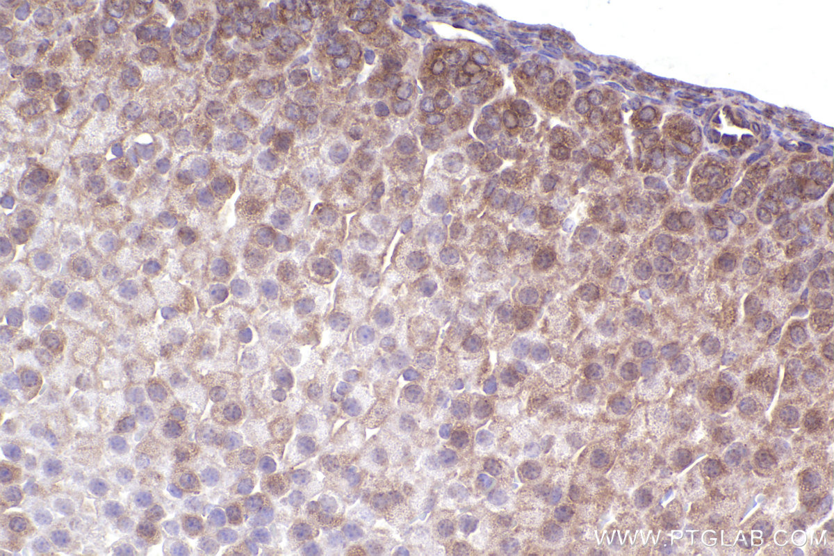 Immunohistochemical analysis of paraffin-embedded mouse adrenal gland tissue slide using KHC2376 (PKD1 IHC Kit).