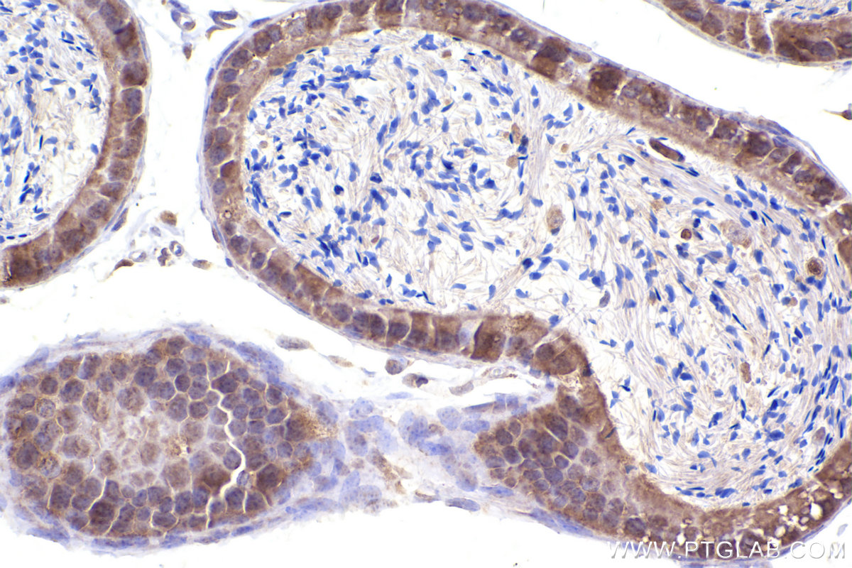 Immunohistochemical analysis of paraffin-embedded mouse epididymis tissue slide using KHC2376 (PKD1 IHC Kit).