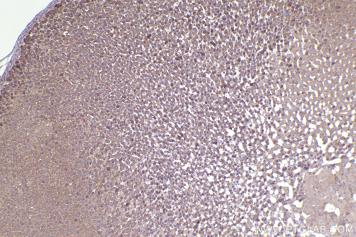 Immunohistochemical analysis of paraffin-embedded rat adrenal gland tissue slide using KHC2376 (PKD1 IHC Kit).