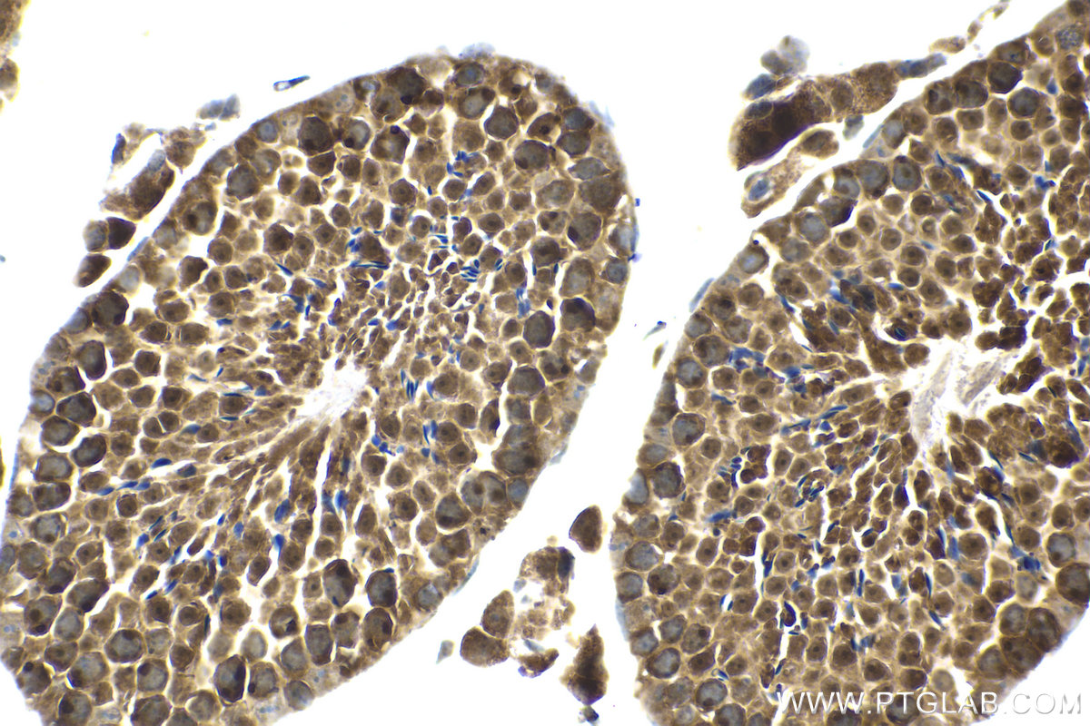 Immunohistochemical analysis of paraffin-embedded mouse testis tissue slide using KHC1515 (PKHD1 IHC Kit).