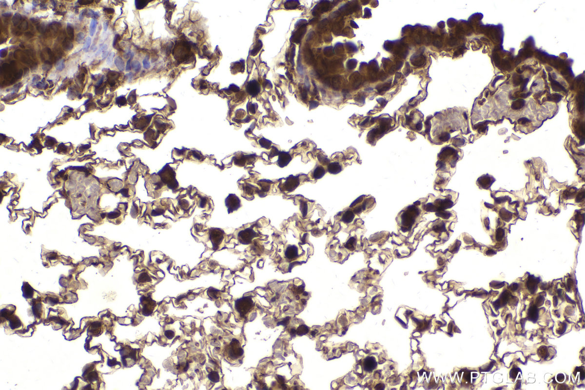 Immunohistochemical analysis of paraffin-embedded mouse lung tissue slide using KHC2184 (PKM2 IHC Kit).