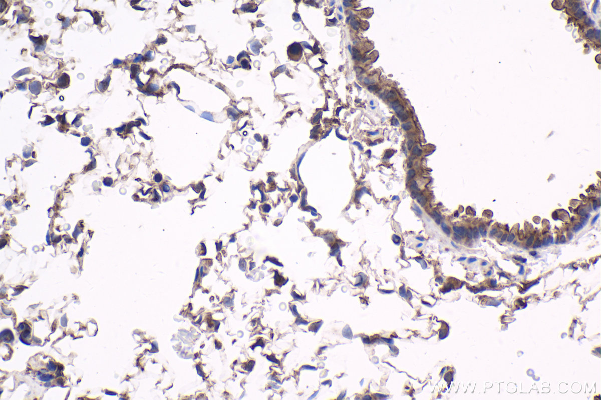 Immunohistochemical analysis of paraffin-embedded rat lung tissue slide using KHC1758 (PKN2 IHC Kit).