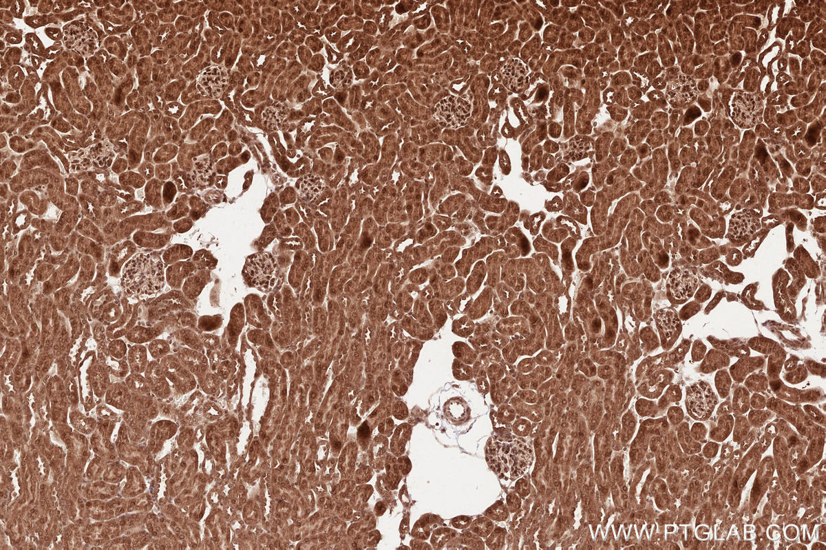 Immunohistochemical analysis of paraffin-embedded mouse kidney tissue slide using KHC2529 (PLK5P IHC Kit).