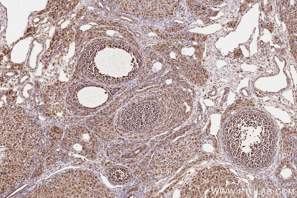 Immunohistochemical analysis of paraffin-embedded rat ovary tissue slide using KHC2529 (PLK5P IHC Kit).