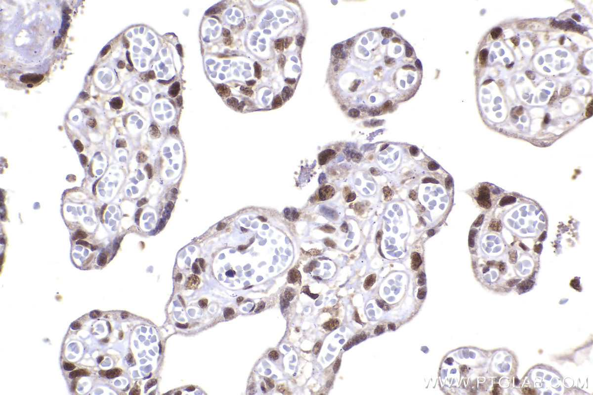 Immunohistochemical analysis of paraffin-embedded human placenta tissue slide using KHC2285 (POLD2 IHC Kit).