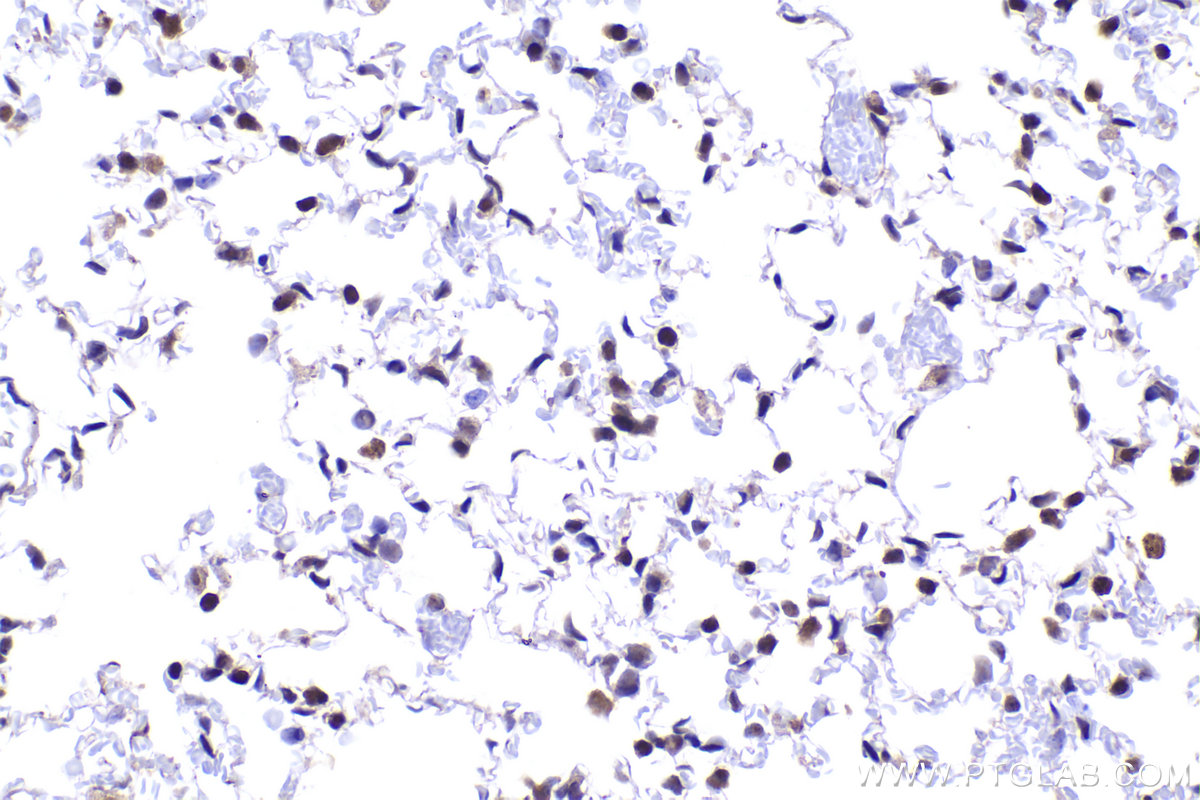 Immunohistochemical analysis of paraffin-embedded mouse lung tissue slide using KHC2285 (POLD2 IHC Kit).