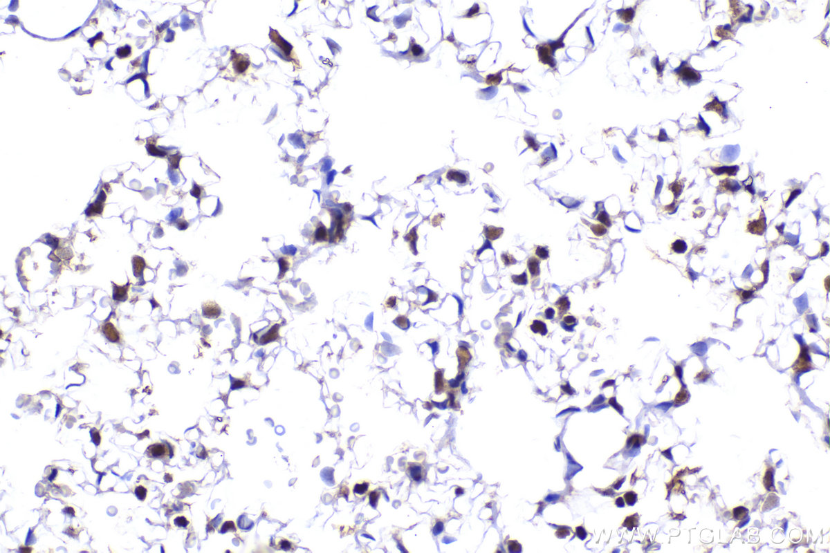 Immunohistochemical analysis of paraffin-embedded rat lung tissue slide using KHC2285 (POLD2 IHC Kit).