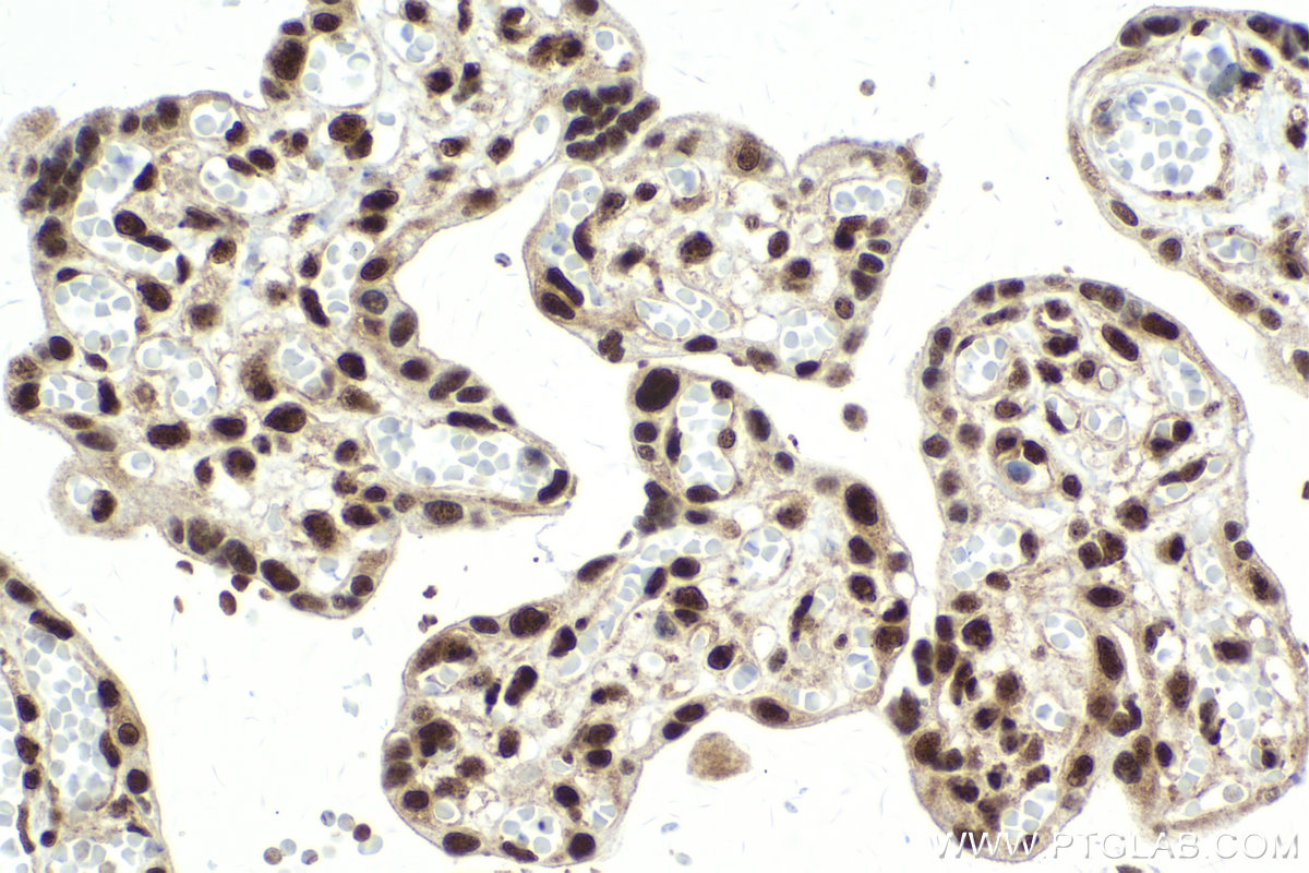 Immunohistochemical analysis of paraffin-embedded human placenta tissue slide using KHC2161 (POLR3D IHC Kit).