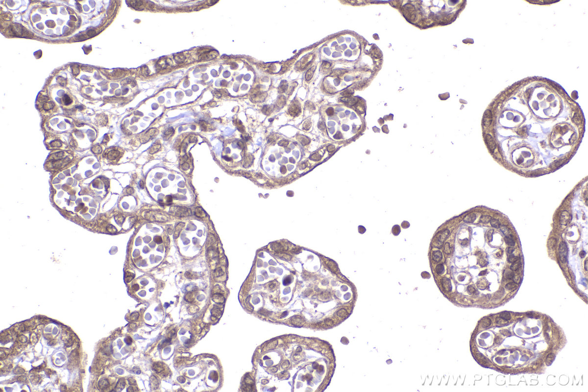 Immunohistochemical analysis of paraffin-embedded human placenta tissue slide using KHC2254 (PPP1CC IHC Kit).