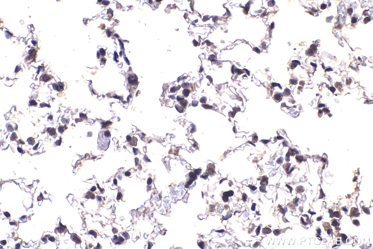 Immunohistochemical analysis of paraffin-embedded mouse lung tissue slide using KHC2254 (PPP1CC IHC Kit).