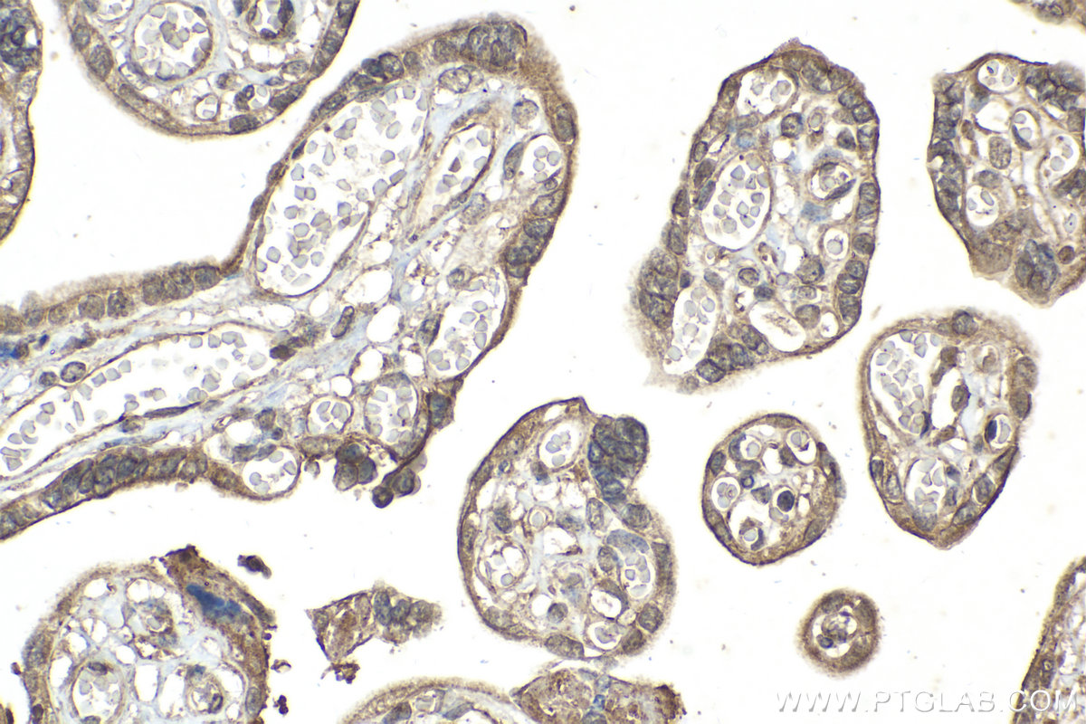 Immunohistochemical analysis of paraffin-embedded human placenta tissue slide using KHC2121 (PPP1R15A/GADD34 IHC Kit).