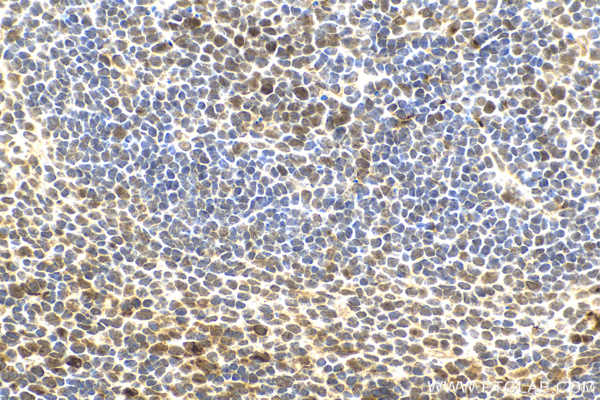 Immunohistochemical analysis of paraffin-embedded mouse spleen tissue slide using KHC2121 (PPP1R15A/GADD34 IHC Kit).