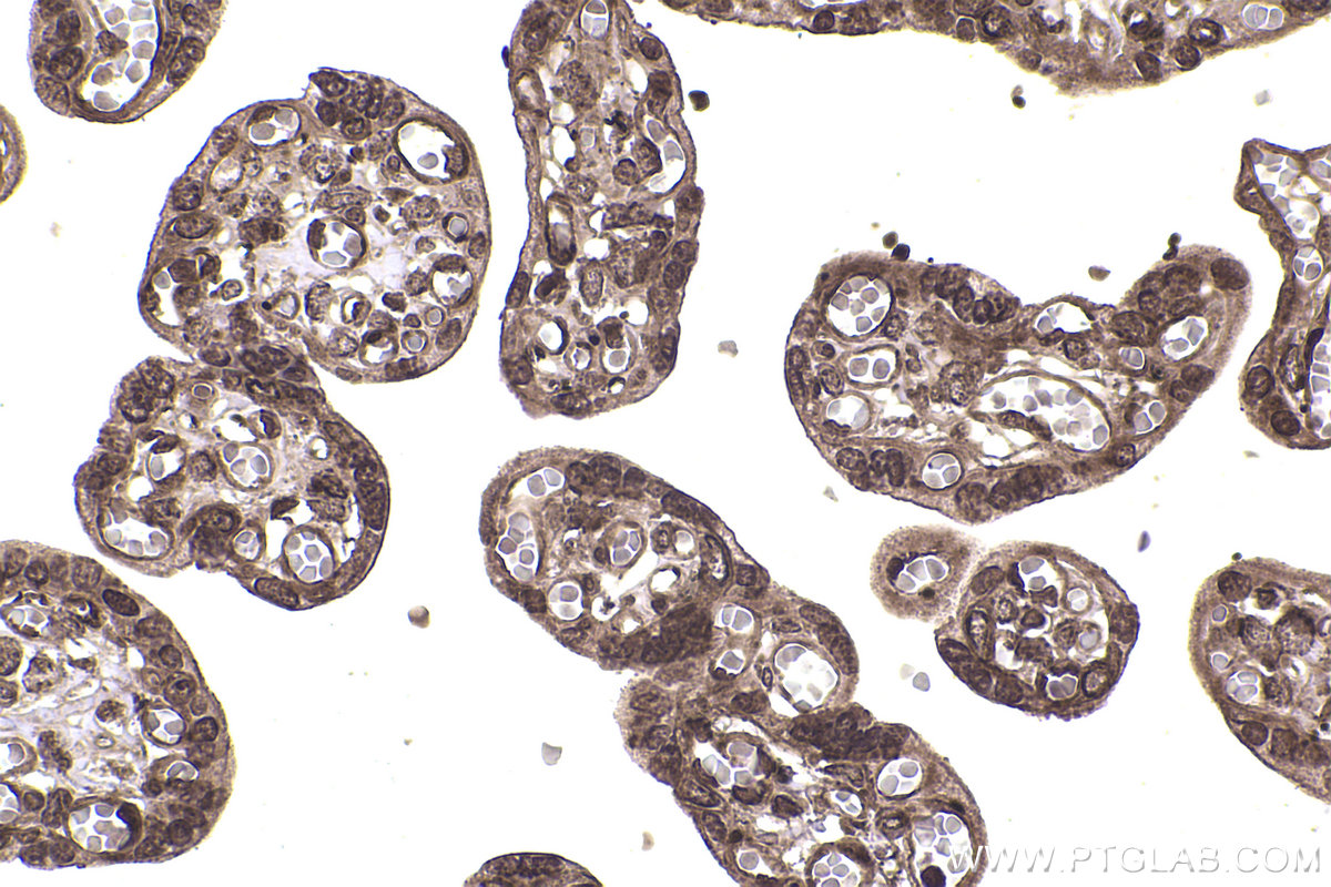 Immunohistochemical analysis of paraffin-embedded human placenta tissue slide using KHC2362 (PPP2CA IHC Kit).