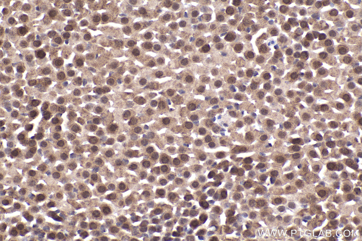 Immunohistochemical analysis of paraffin-embedded mouse adrenal gland tissue slide using KHC2226 (PPP2R1A IHC Kit).