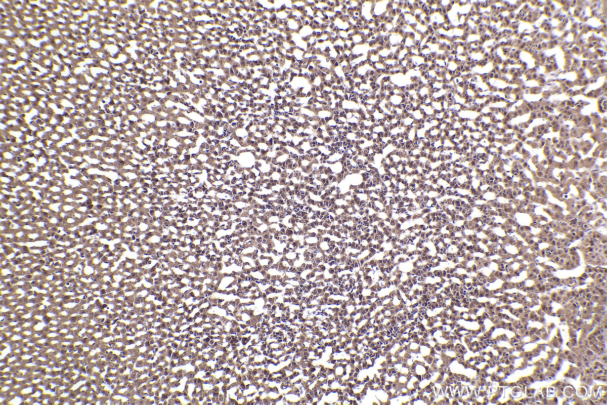 Immunohistochemical analysis of paraffin-embedded rat adrenal gland tissue slide using KHC2226 (PPP2R1A IHC Kit).