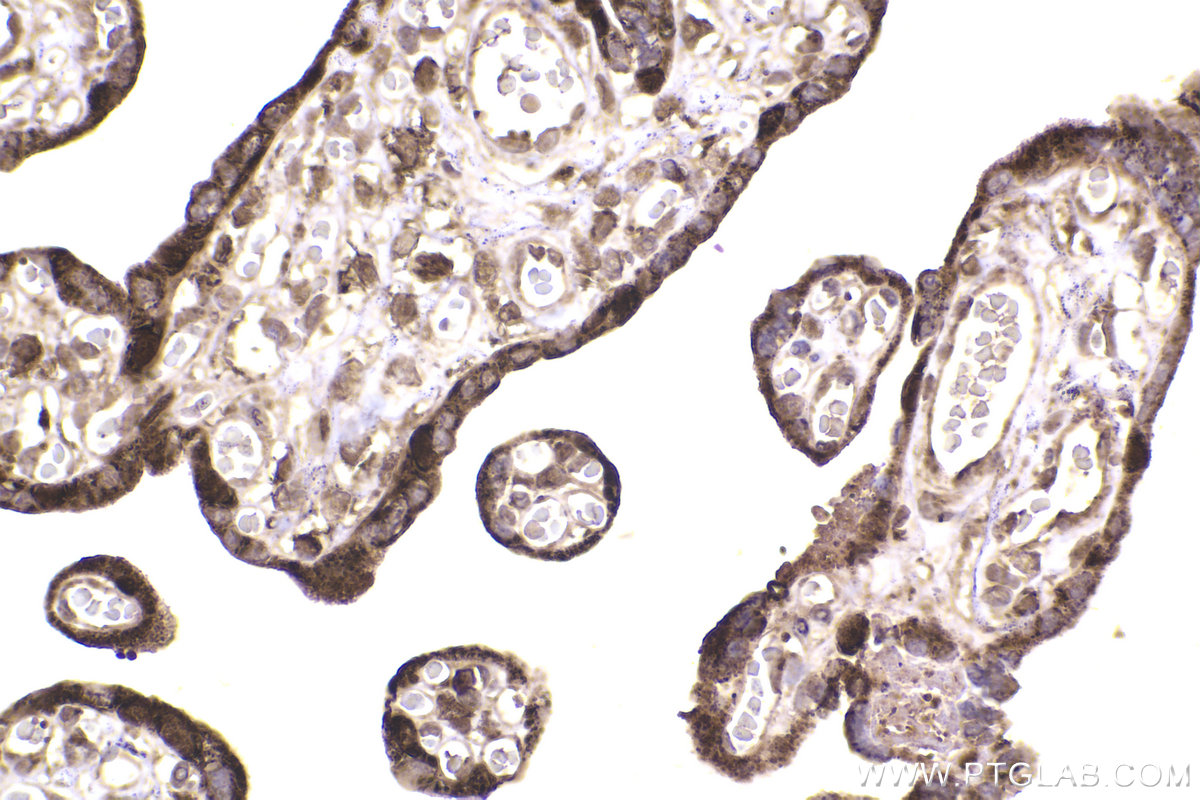 Immunohistochemical analysis of paraffin-embedded human placenta tissue slide using KHC2224 (PRDX5 IHC Kit).