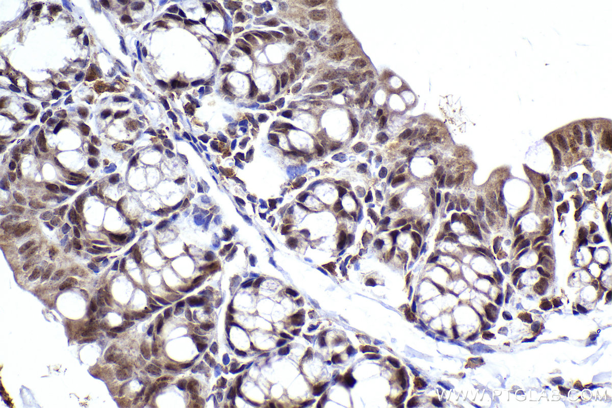 Immunohistochemical analysis of paraffin-embedded mouse small intestine tissue slide using KHC2288 (PRIM1 IHC Kit).