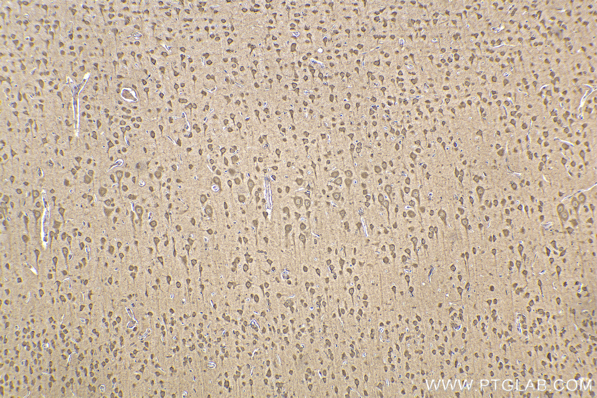 Immunohistochemical analysis of paraffin-embedded rat brain tissue slide using KHC2208 (PRKACB IHC Kit).