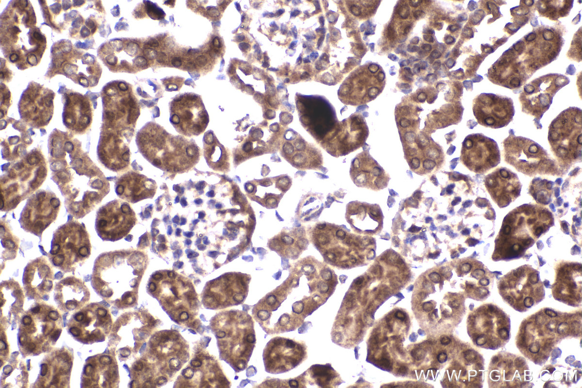 Immunohistochemical analysis of paraffin-embedded mouse kidney tissue slide using KHC2324 (PRKAG1 IHC Kit).