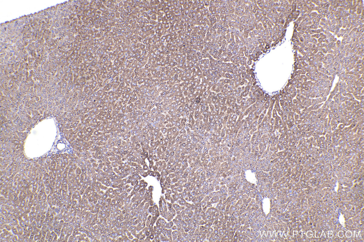 Immunohistochemical analysis of paraffin-embedded mouse liver tissue slide using KHC2324 (PRKAG1 IHC Kit).