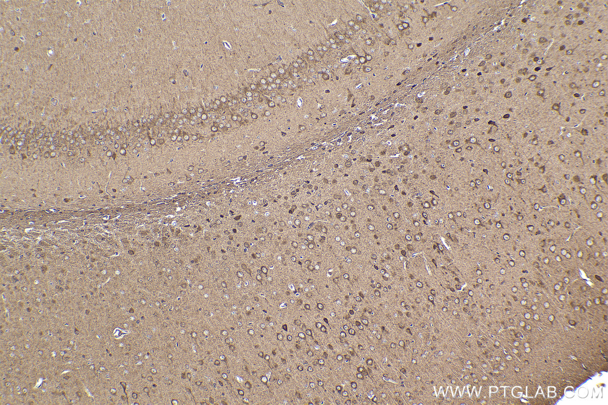 Immunohistochemical analysis of paraffin-embedded mouse brain tissue slide using KHC2175 (PRKAR1A IHC Kit).