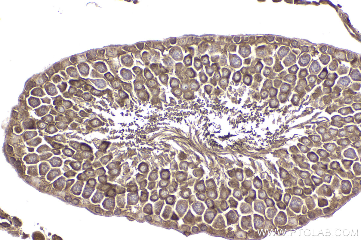 Immunohistochemical analysis of paraffin-embedded rat testis tissue slide using KHC2175 (PRKAR1A IHC Kit).