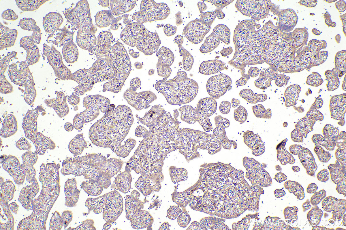 Immunohistochemical analysis of paraffin-embedded human placenta tissue slide using KHC2375 (PRR5 IHC Kit).