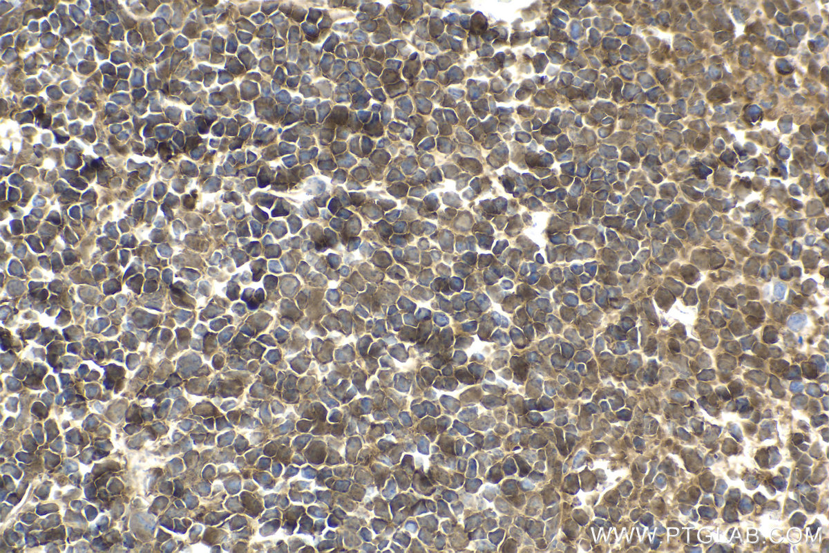 Immunohistochemical analysis of paraffin-embedded mouse spleen tissue slide using KHC1570 (PSMB9 IHC Kit).