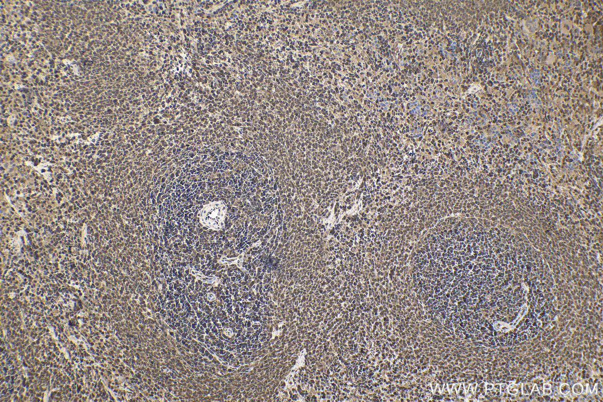 Immunohistochemical analysis of paraffin-embedded rat spleen tissue slide using KHC1570 (PSMB9 IHC Kit).