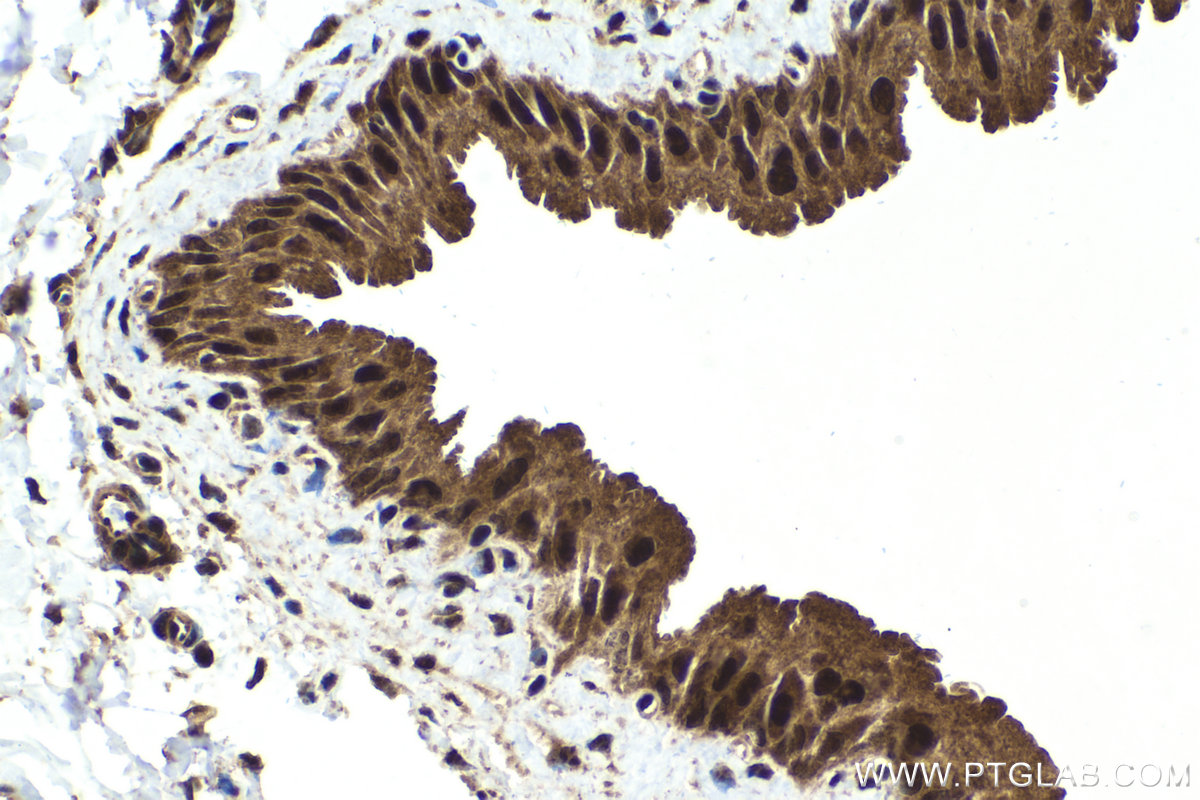 Immunohistochemical analysis of paraffin-embedded rat bladder tissue slide using KHC1644 (PSMC1 IHC Kit).