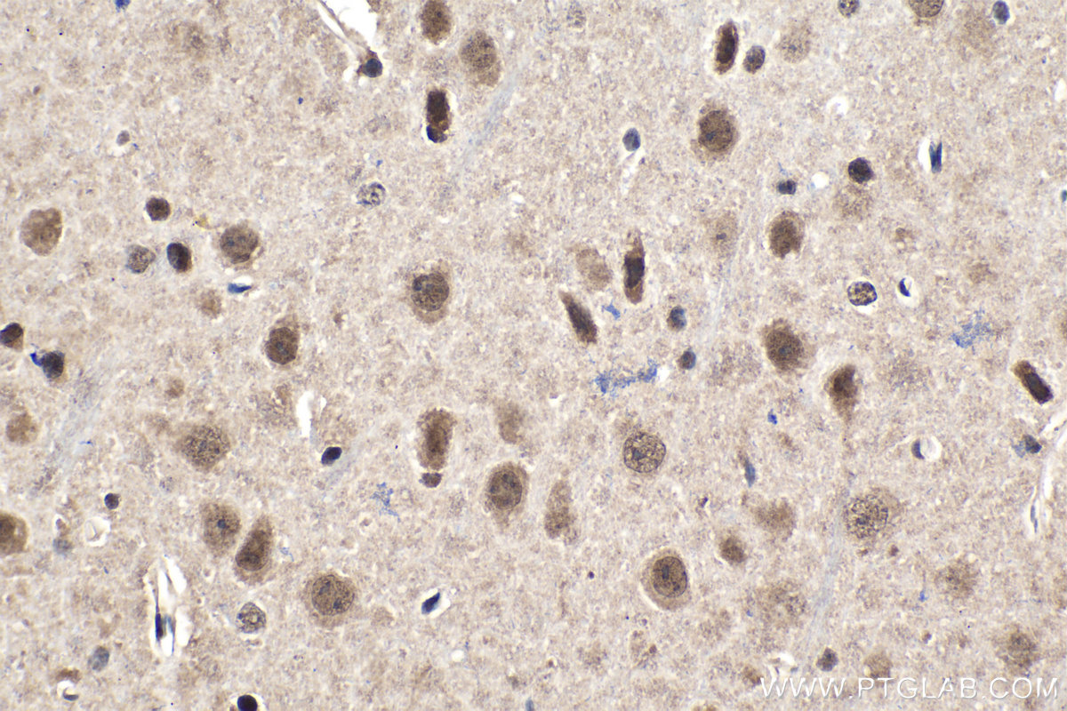 Immunohistochemical analysis of paraffin-embedded mouse brain tissue slide using KHC1541 (PSMC3 IHC Kit).