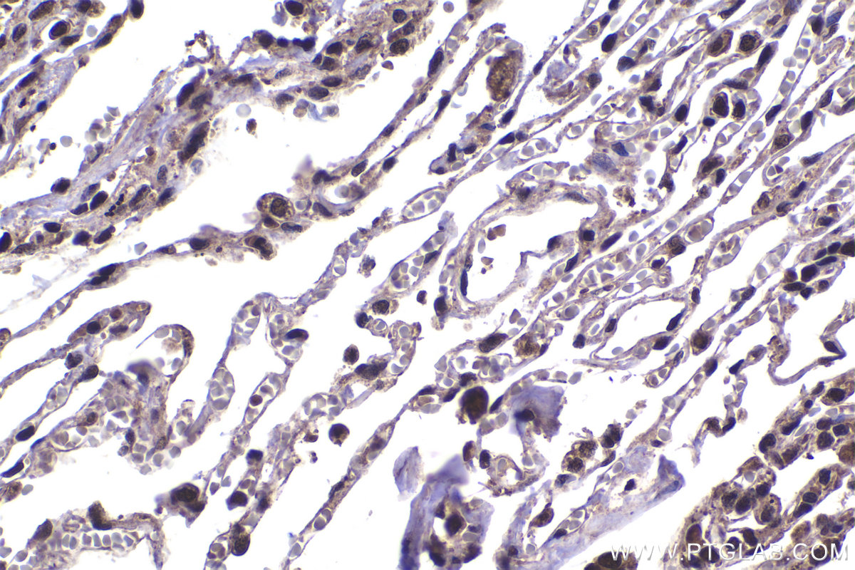 Immunohistochemical analysis of paraffin-embedded human lung tissue slide using KHC1419 (PSMD11 IHC Kit).