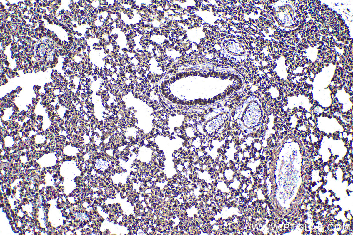 Immunohistochemical analysis of paraffin-embedded mouse lung tissue slide using KHC1419 (PSMD11 IHC Kit).