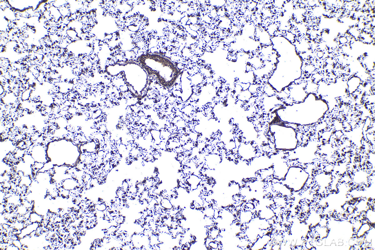 Immunohistochemical analysis of paraffin-embedded rat lung tissue slide using KHC1419 (PSMD11 IHC Kit).