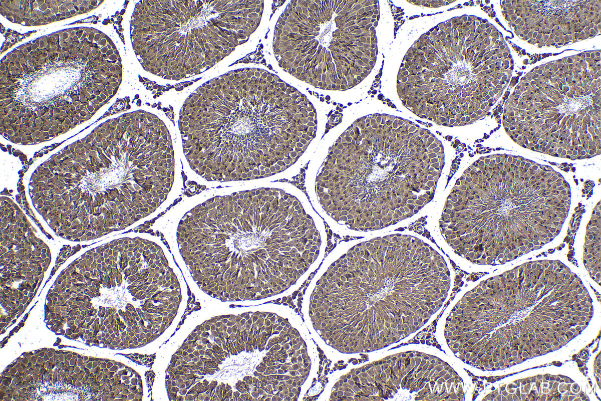 Immunohistochemical analysis of paraffin-embedded rat testis tissue slide using KHC1419 (PSMD11 IHC Kit).