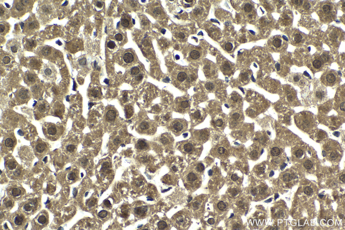 Immunohistochemical analysis of paraffin-embedded mouse liver tissue slide using KHC2042 (PSMD12 IHC Kit).